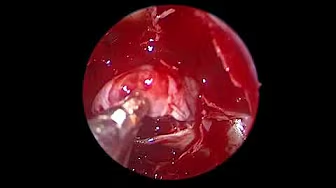 Surgery Procedure 2